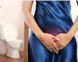 candidiasis